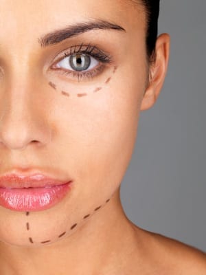 Should I use Fillers or…have Surgery?