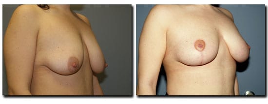 patient photo