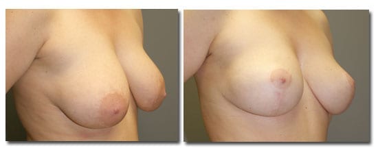 patient photo