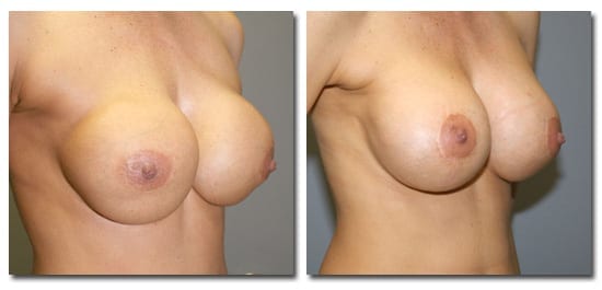 patient photo