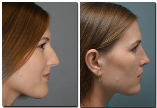 patient photo