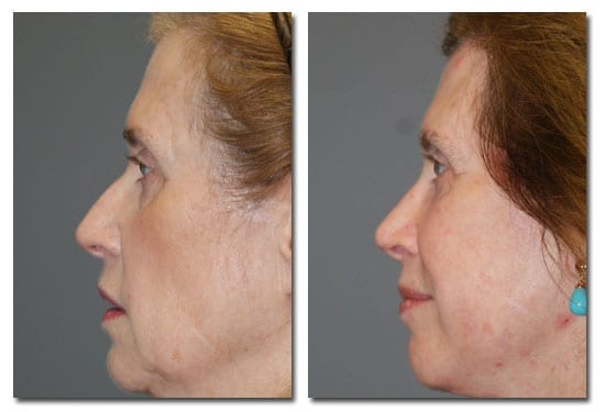patient photo
