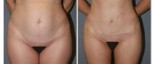 patient photo