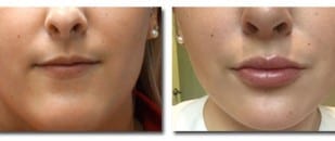 patient photo
