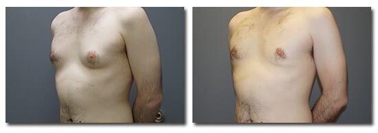 patient photo