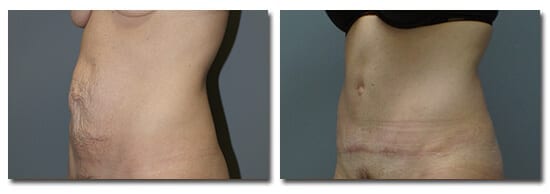 patient photo