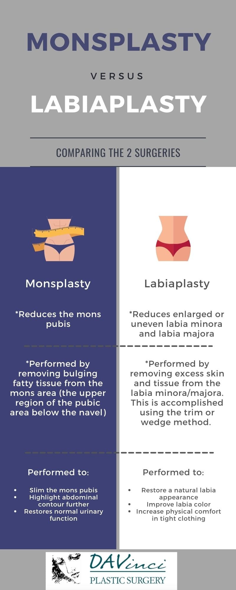 Infographic showing the differences between labiaplasty and monsplasty.