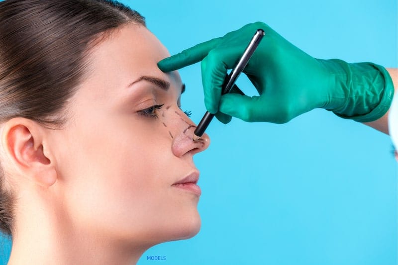 Surgeon marking woman's nose, wearing a green surgical glove. 