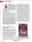 Article: Sentinel Lymph Node Biopsy in the Setting of Conjunctival Melanoma