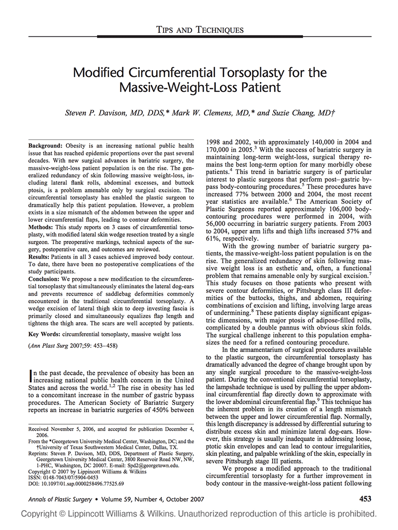 Article: Modified Circumferential Torsoplasty For The Massive-weight-loss Patient