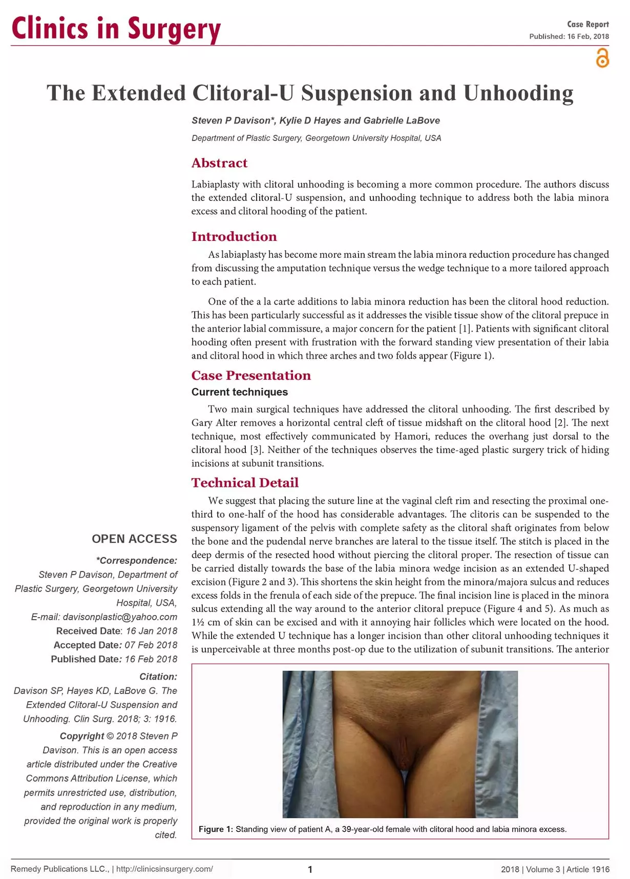 Article: The Extended Clitoral-U Suspension and Unhooding