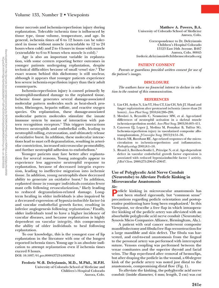 Article: Use of polyglycolic acid nerve conduit (neurotube) to alleviate pedicle kinking in microvascular anastomosis