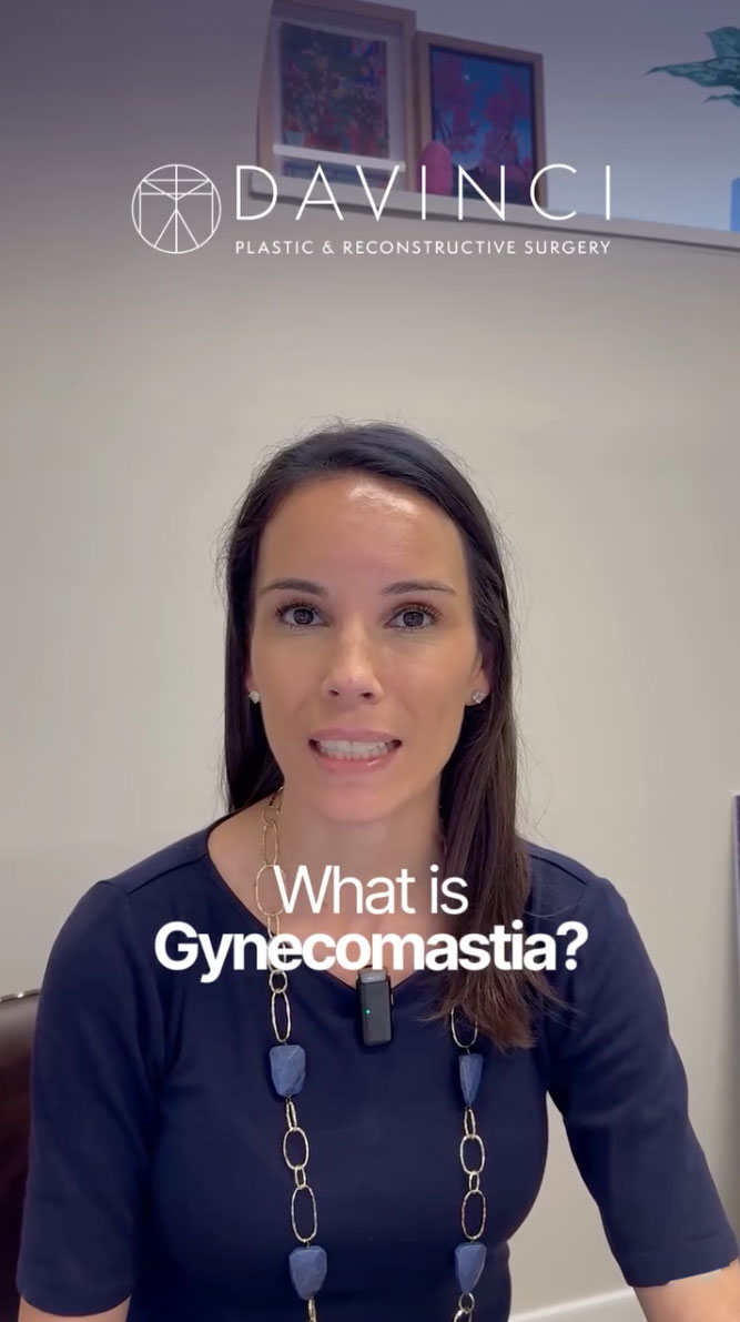 Gynecomastia