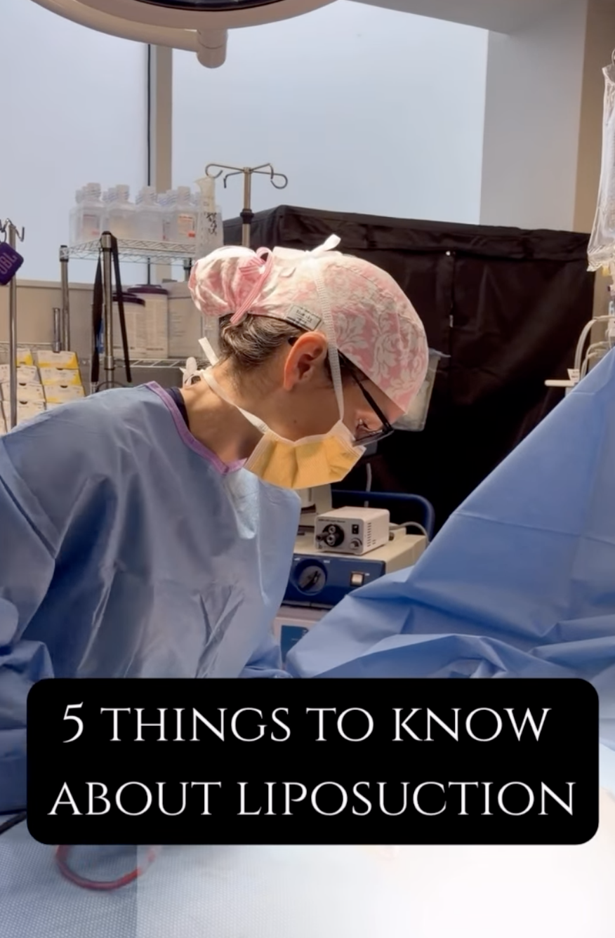 5 𝘛𝘩𝘪𝘯𝘨𝘴 𝘵𝘰 𝘒𝘯𝘰𝘸 𝘢𝘣𝘰𝘶𝘵 𝘓𝘪𝘱𝘰𝘴𝘶𝘤𝘵𝘪𝘰𝘯 1. It’s for contouring—not weight loss. Liposuction targets stubborn areas of fat to improve shape and proportion.