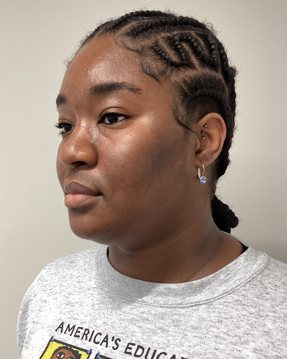 Case--9954 | Before Liposuction