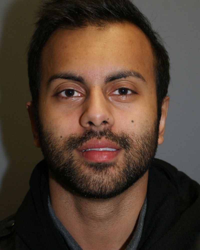 Otoplasty - Ear Surgery 4927 Post